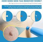 ✨ Acrochordon Skin Tag Remover Kit – 2-in-1 Fast & Painless Solution 🩹💖