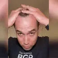 🌿✨ FEG Hair Growth Spray – Stop Hair Fall, Regrow Naturally & Strengthen Roots 💧💪